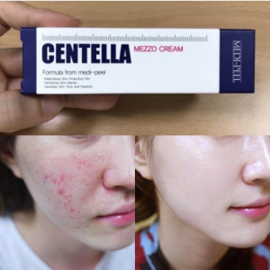 Kem Rau Má Giảm Mụn Phục Hồi Da MEDI-PEEL CENTELLA MEZZO CREAM