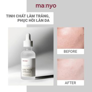 TINH CHẤT DƯỠNG TRẮNG DA MANYO Galac Niacin 2.0 Essence 30ml