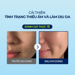 Mặt Nạ Torriden Dưỡng Ẩm Sâu Cho Da 27ml