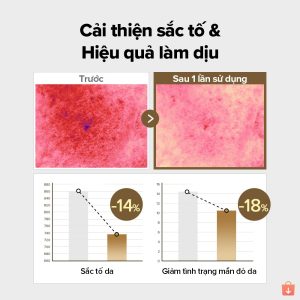 Toner Pad làm dịu và sáng da SKINFOOD Potato Madecassoside (Hộp 60 miếng)