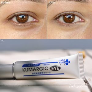 Kem ngăn ngừa thâm quầng mắt Kumargic Eye Nhật Bản 20g (Bản mới)