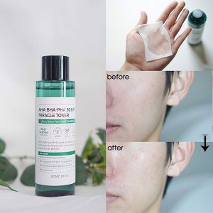 Nước Hoa Hồng Giảm Mụn Some By Mi AHABHAPHA 30 Days Miracle Toner 150ml