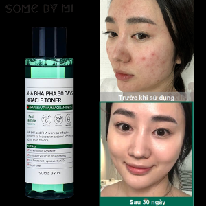 Nước Hoa Hồng Giảm Mụn Some By Mi AHABHAPHA 30 Days Miracle Toner 150ml